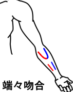 端々吻合イラスト